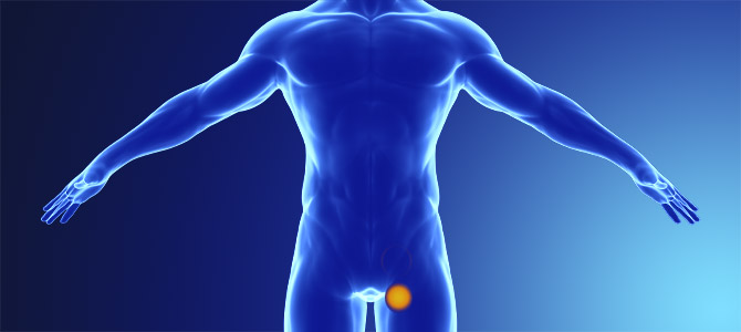 Femoral Hernia